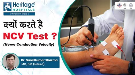 ncv test package|R: Non.